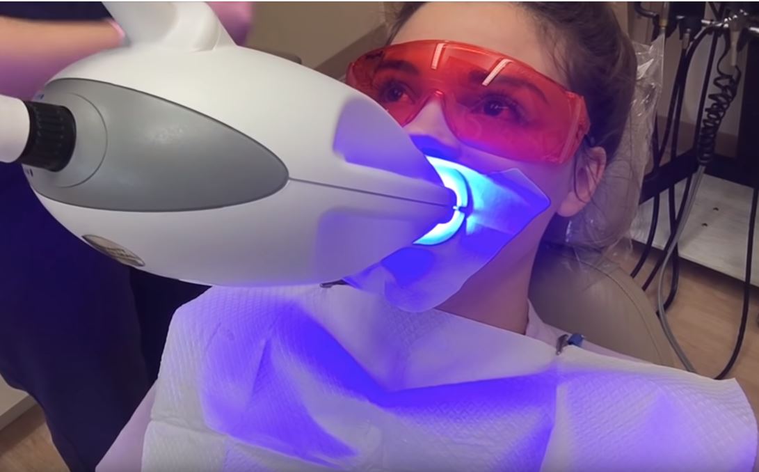 precio blanqueamiento dental laser mexico