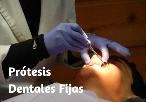 Protesis Dentales Fijas