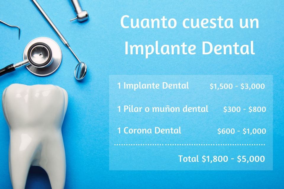 precios implantes dentales estados unidos